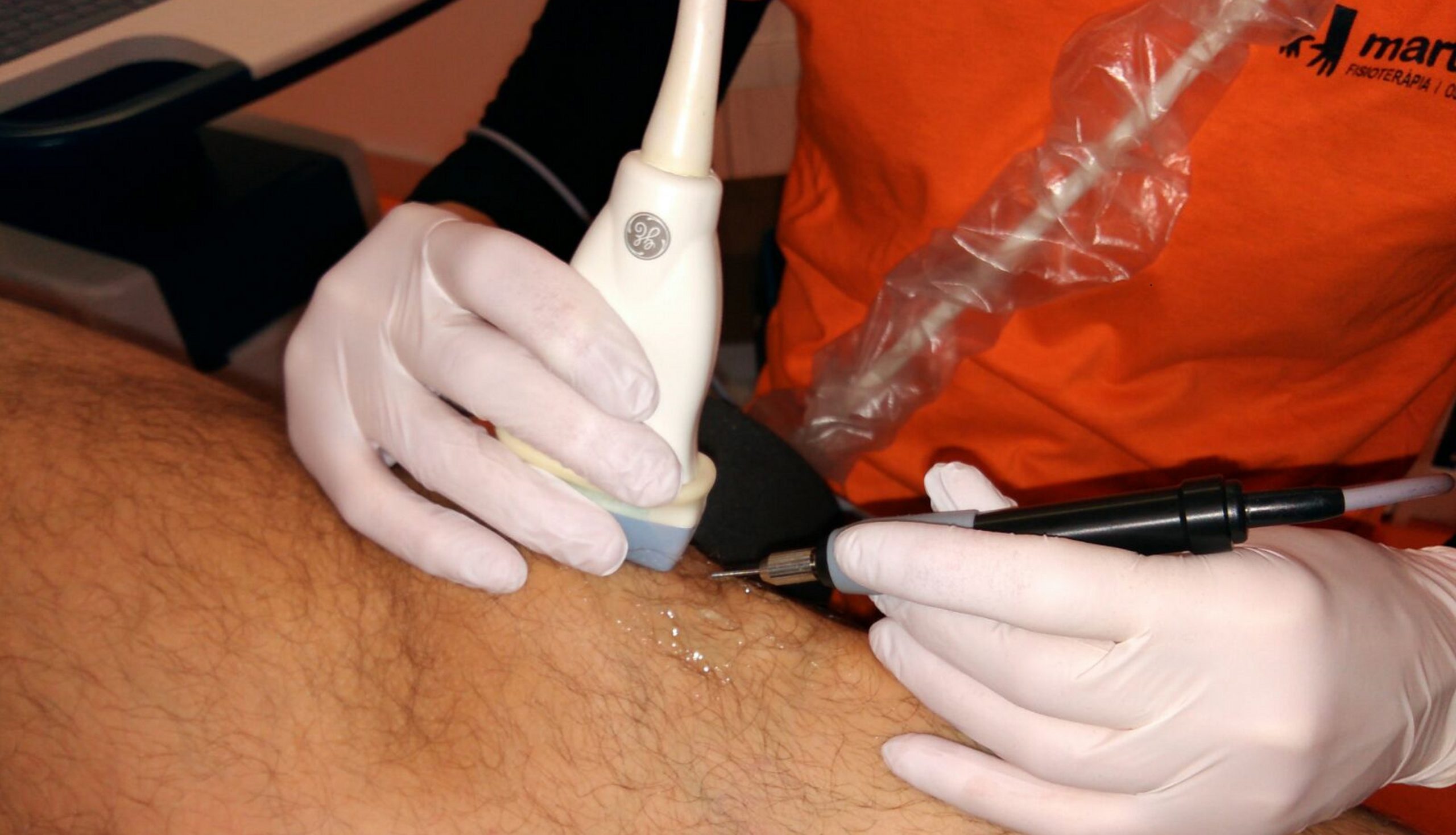 electrolisis-marta-bono1